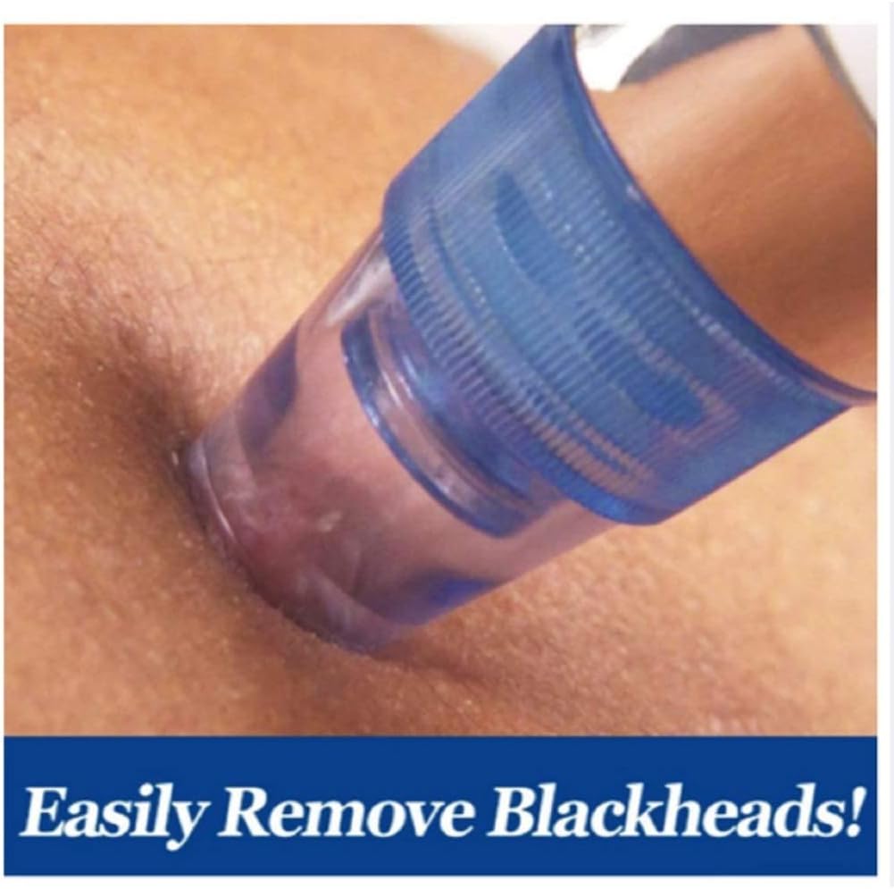 pore cleansing device